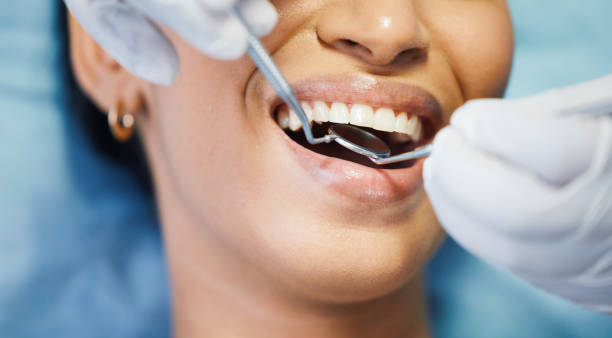 Best Teeth Whitening  in Seffner, FL